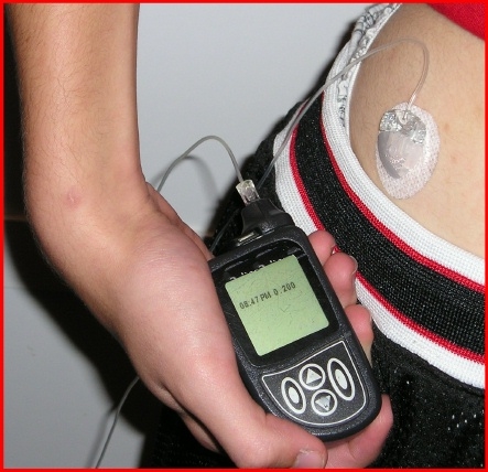 Insulin Pump Therapy Online Course